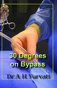 Cover 30 Degrees on Bypass