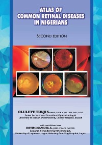 Cover The Atlas of Retinal Diseases in Nigerians