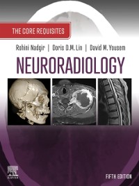 Cover Neuroradiology: The Requisites