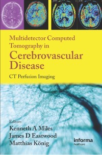 Cover Multidetector Computed Tomography in Cerebrovascular Disease