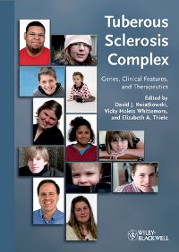 Cover Tuberous Sclerosis Complex