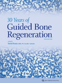 Cover 30 Years of Guided Bone Regeneration