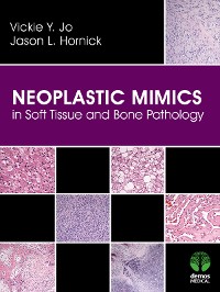 Cover Neoplastic Mimics in Soft Tissue and Bone Pathology
