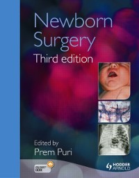 Cover Newborn Surgery 3E