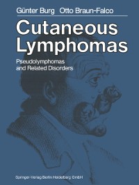 Cover Cutaneous Lymphomas, Pseudolymphomas, and Related Disorders