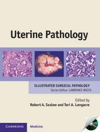 Cover Uterine Pathology