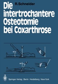 Cover Die intertrochantere Osteotomie bei Coxarthrose