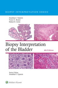 Cover Biopsy Interpretation of the Bladder