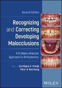 Cover Recognizing and Correcting Developing Malocclusions