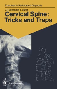 Cover Cervical Spine: Tricks and Traps