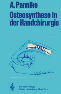 Cover Osteosynthese in der Handchirurgie