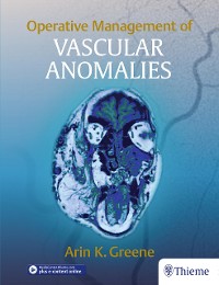 Cover Operative Management of Vascular Anomalies