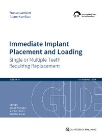 Cover Immediate Implant Placement and Loading – Single or Multiple Teeth Requiring Replacement