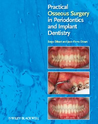 Cover Practical Osseous Surgery in Periodontics and Implant Dentistry