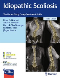 Cover Idiopathic Scoliosis