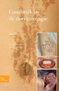 Cover Casuïstiek in de dermatologie - deel 2