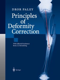 Cover Principles of Deformity Correction