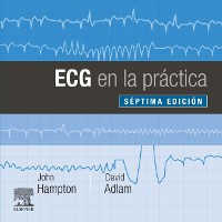 Cover ECG en la práctica