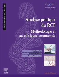 Cover Analyse pratique  du RCF : rythme cardiaque foetal