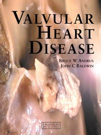 Cover Valvular Heart Disease