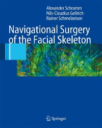 Cover Navigational Surgery of the Facial Skeleton