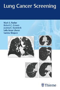 Cover Lung Cancer Screening