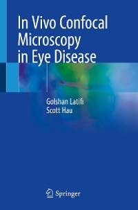 Cover In Vivo Confocal Microscopy in Eye Disease