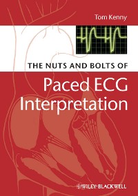 Cover The Nuts and bolts of Paced ECG Interpretation