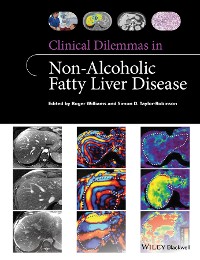 Cover Clinical Dilemmas in Non-Alcoholic Fatty Liver Disease