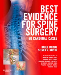 Cover Best Evidence for Spine Surgery E-Book